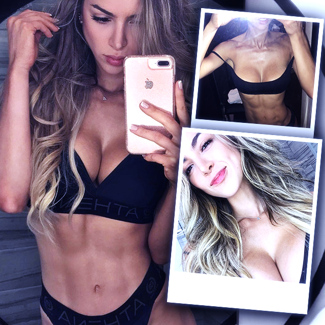Anllela sagra before and after surgery